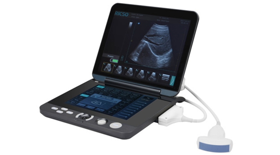 移动超声诊断系统